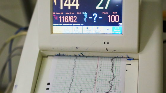 CTG in Pregnancy Cardiotocography